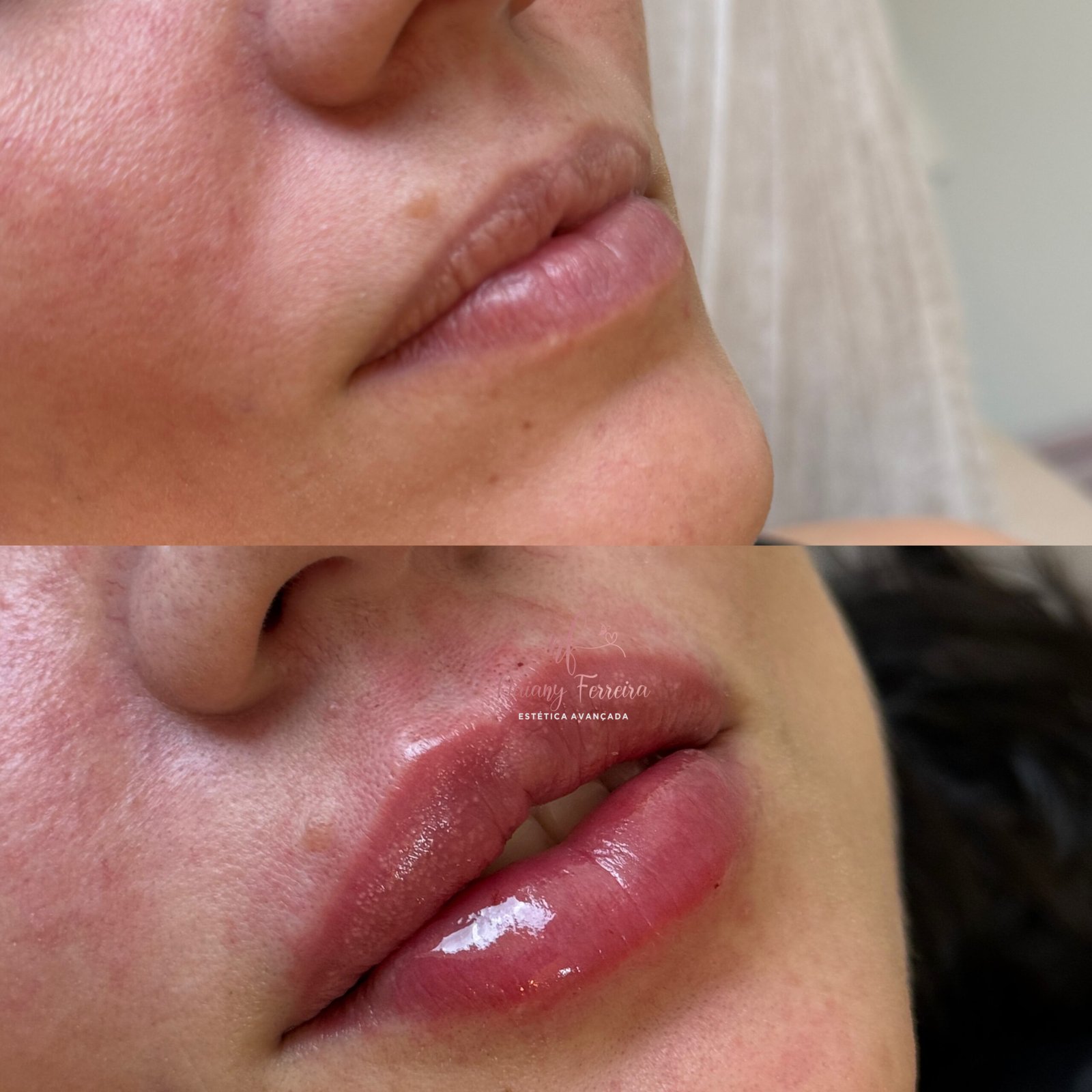 Resultado de estética avançada