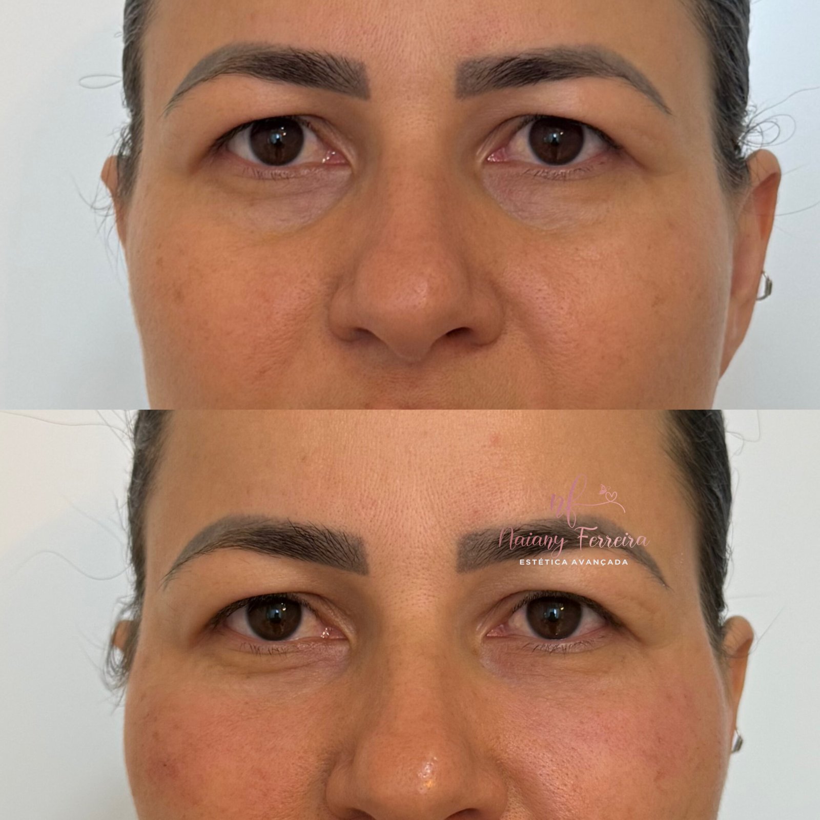 Resultado estético facial