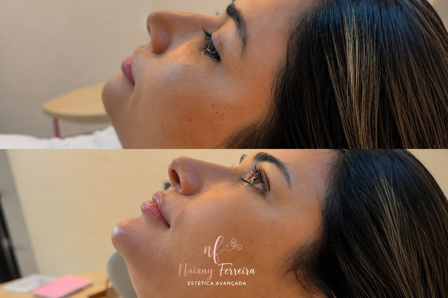 Resultado de perfil facial